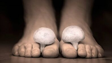 How to recognize the presence of fungus on the feet