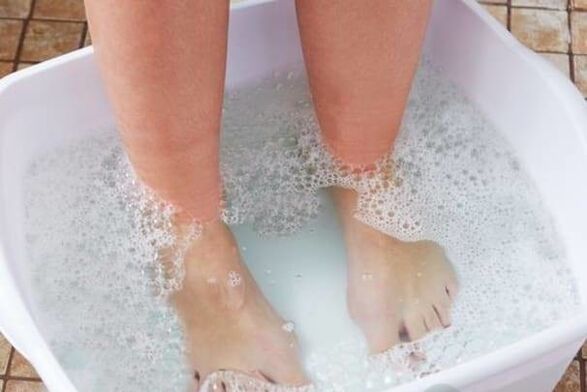 Treatment of nail fungus with folk remedies