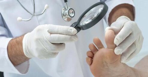 foot fungus treatment by a doctor