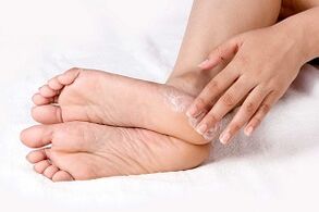 treatment of foot fungus with cream