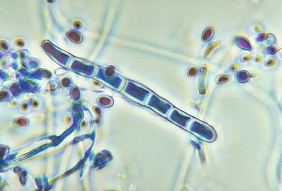 Fungi Trichophyton rubrum under a microscope